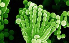 食用菌制種如何預(yù)防病菌？